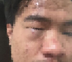 Saling lirik ,Seorang Pengunjung THM Bonyok di keroyok