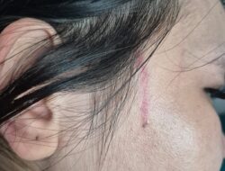 Dugaan Pengeroyokan DJ Oleh LC First Club, Ini Penjelasan Polsek Lubuk Baja