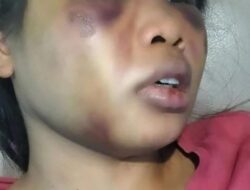 Sidang Lanjutan Kasus Majikan Aniaya ART akan Digelar Hari ini, Korban Dipastikan Hadir