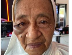 ‎Tega! Perampok di Batam Hajar Nenek 75 Tahun Hingga Pingsan, Gelang Emas 60 Gram Raib ‎