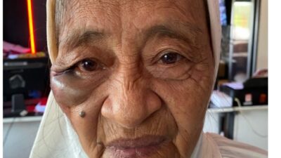 ‎Tega! Perampok di Batam Hajar Nenek 75 Tahun Hingga Pingsan, Gelang Emas 60 Gram Raib ‎